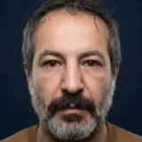 فولغا سورغو